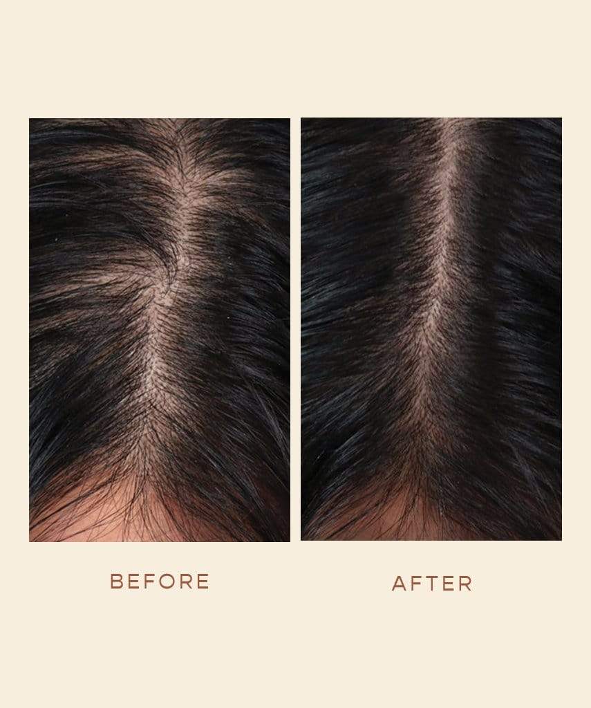 GRO Hair Serum
