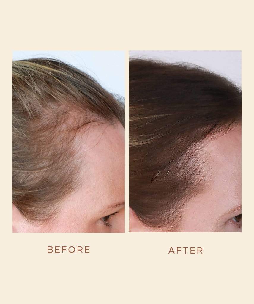 GRO Hair Serum (3 Month Course)
