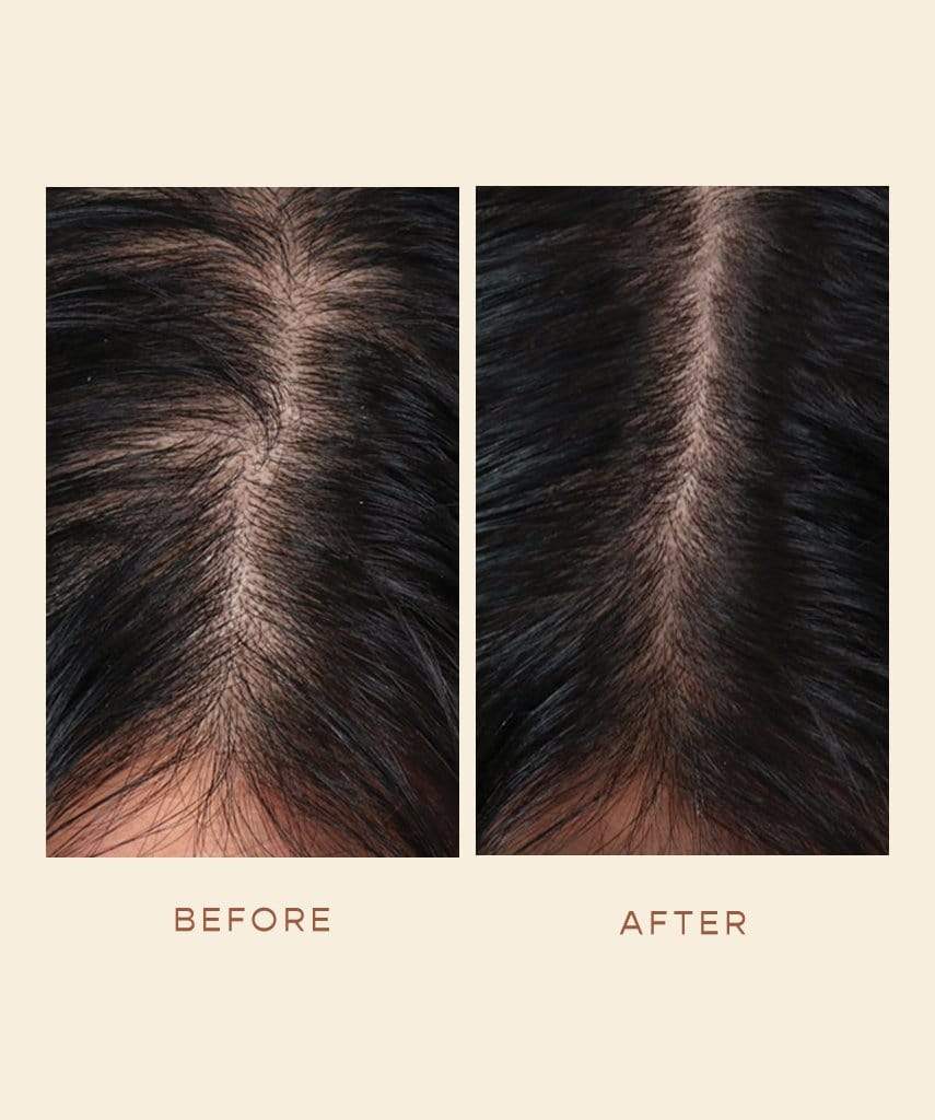 GRO Hair Serum (3 Month Course)