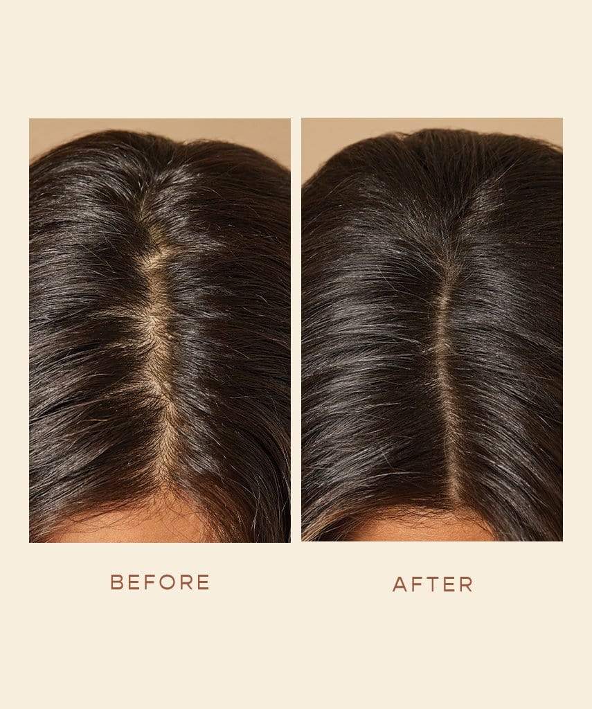 GRO Hair Foam (3 Month Course)