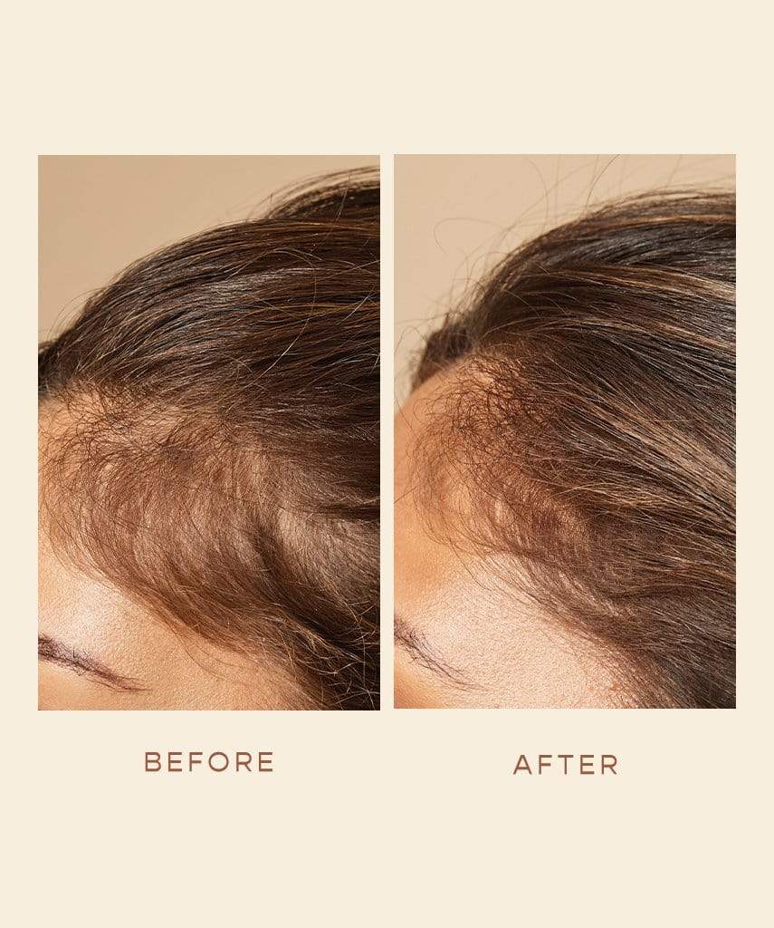 GRO Hair Foam (3 Month Course)